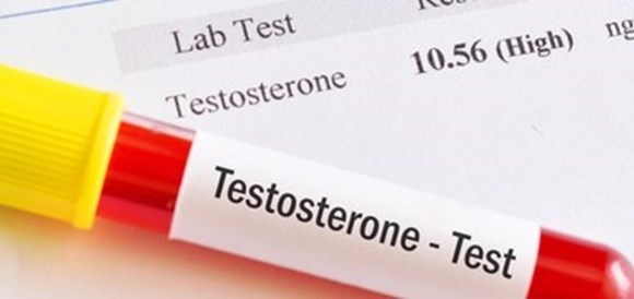 צילום: שאטרסטוק בדיקת טסטוסטרון (Testosteron) - תמונה